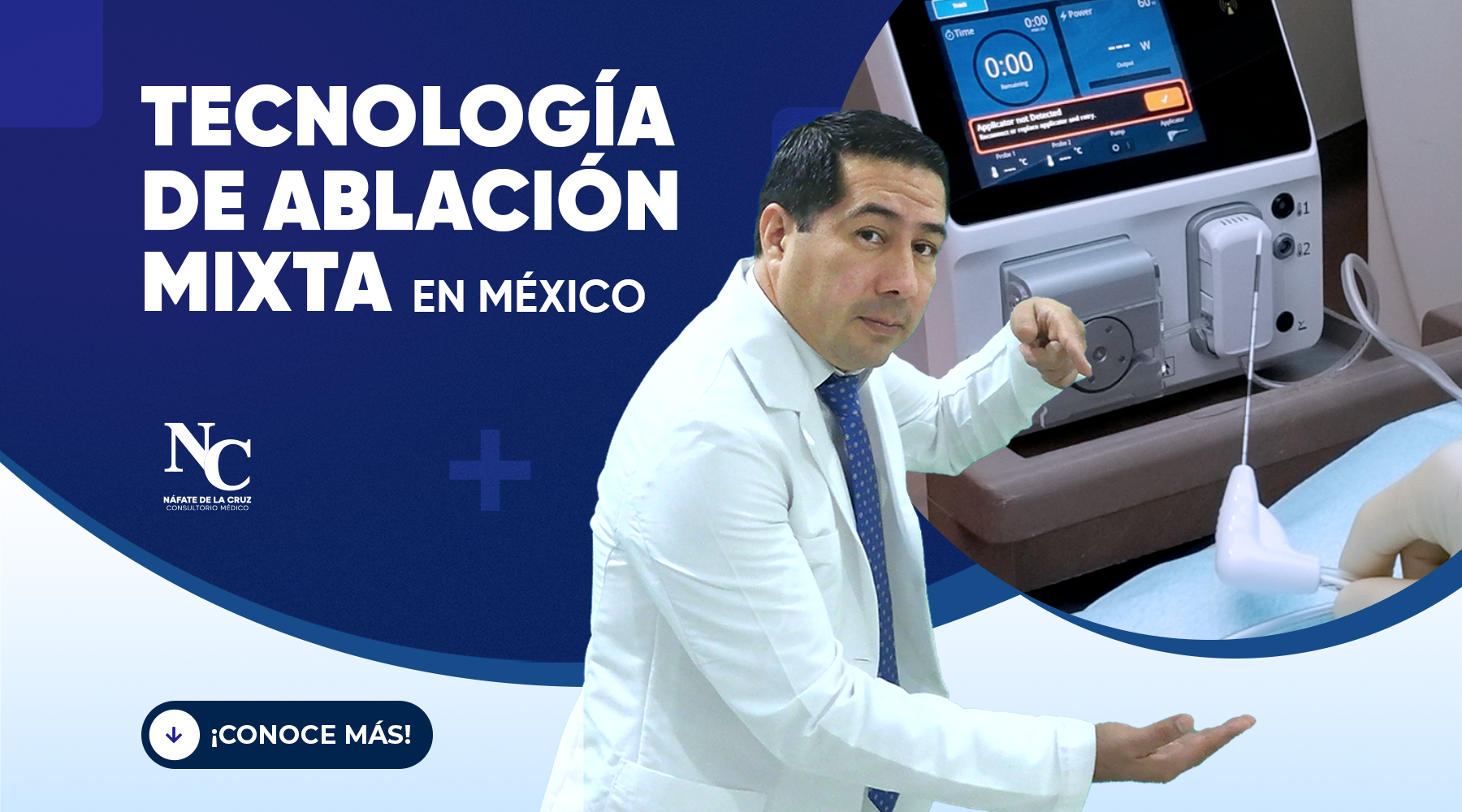 Tecnología de ablación mixta en México