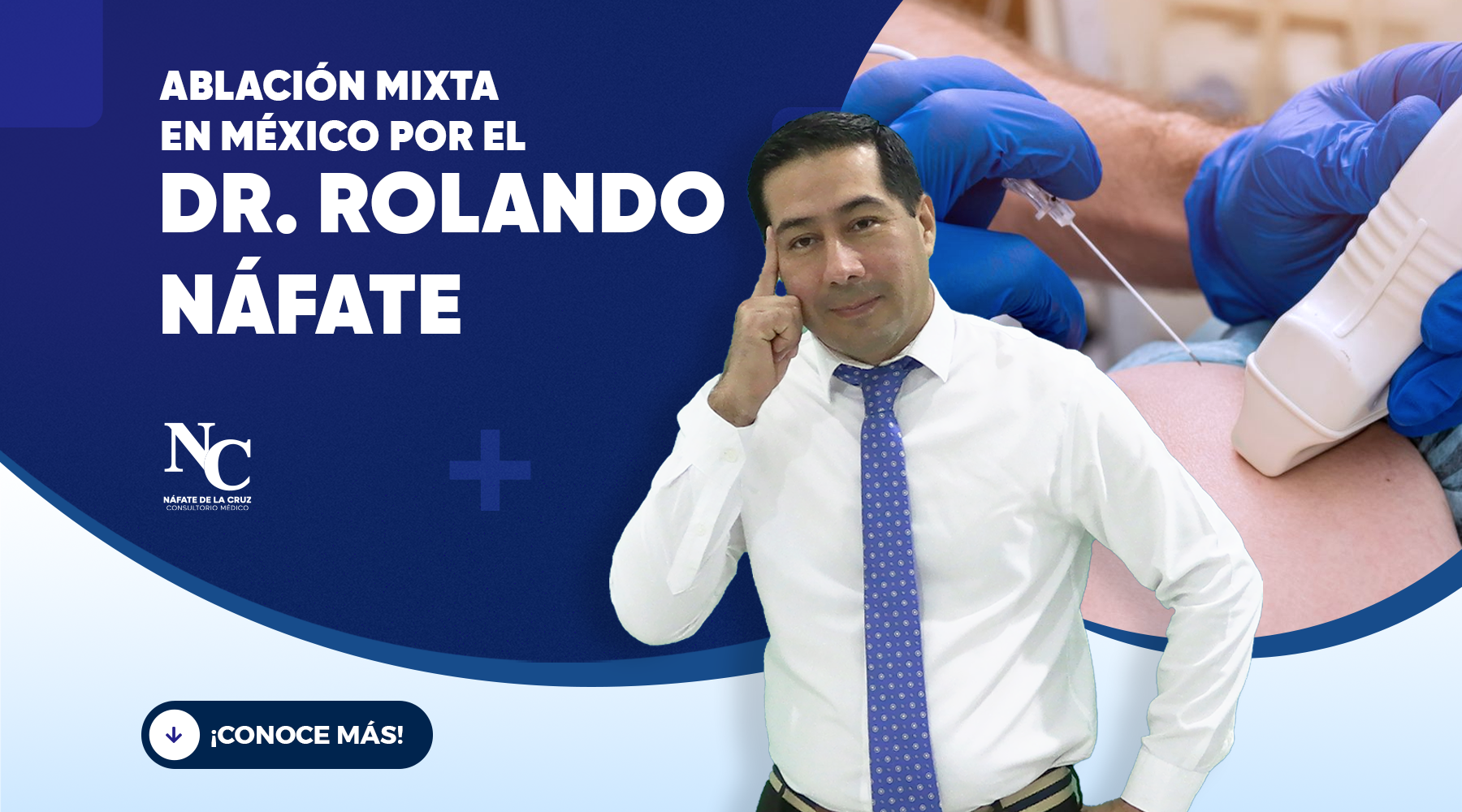 Ablación mixta en México