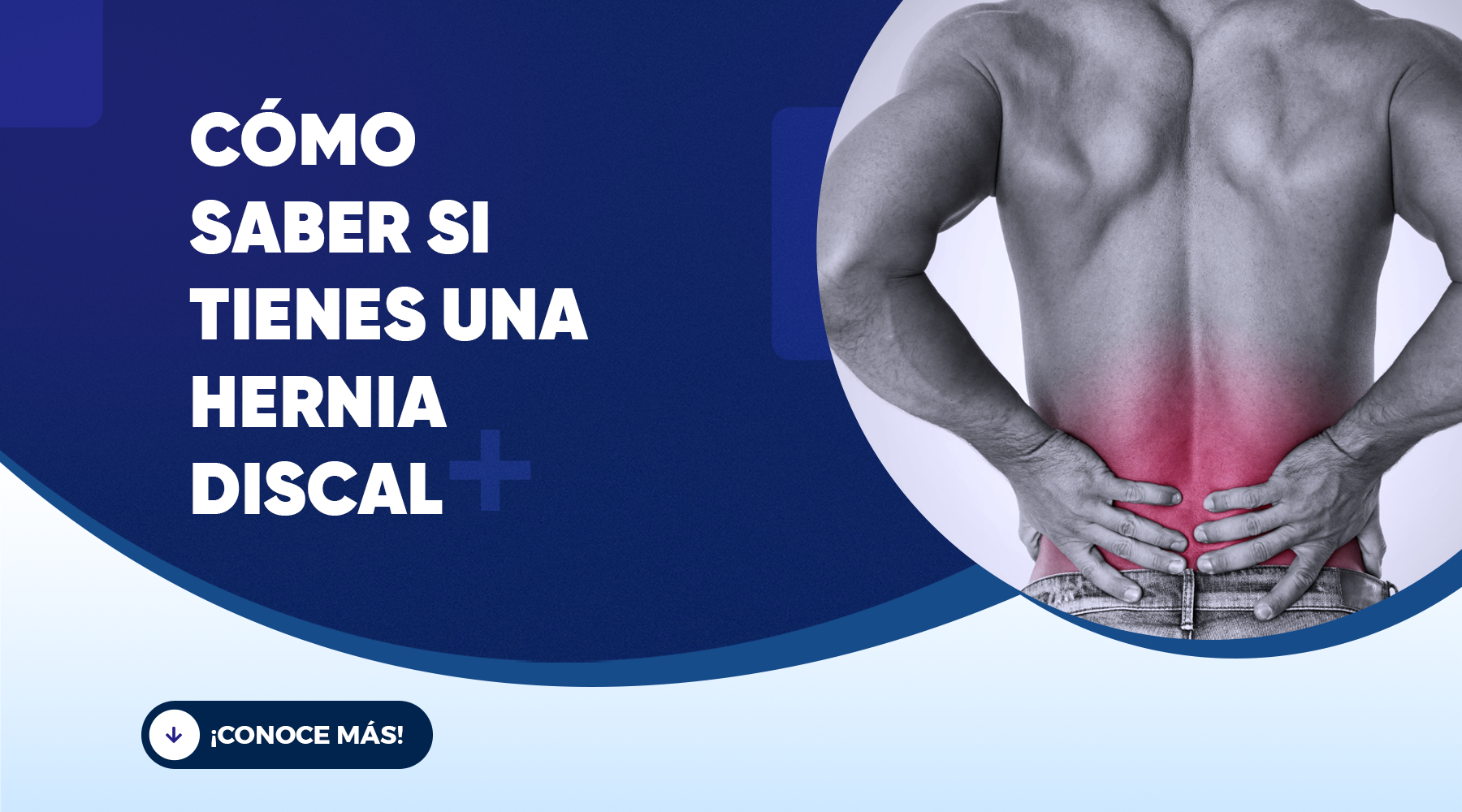 Hernia discal