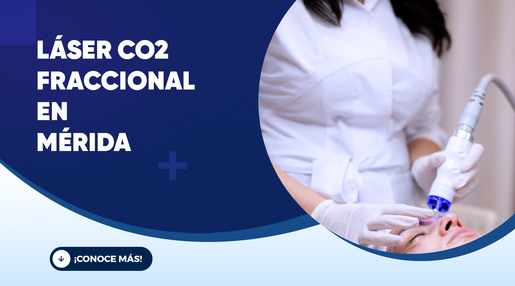 Láser CO₂ fraccional en Mérida