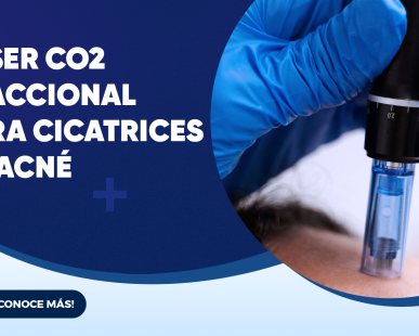 Láser CO₂ para cicatrices de acné