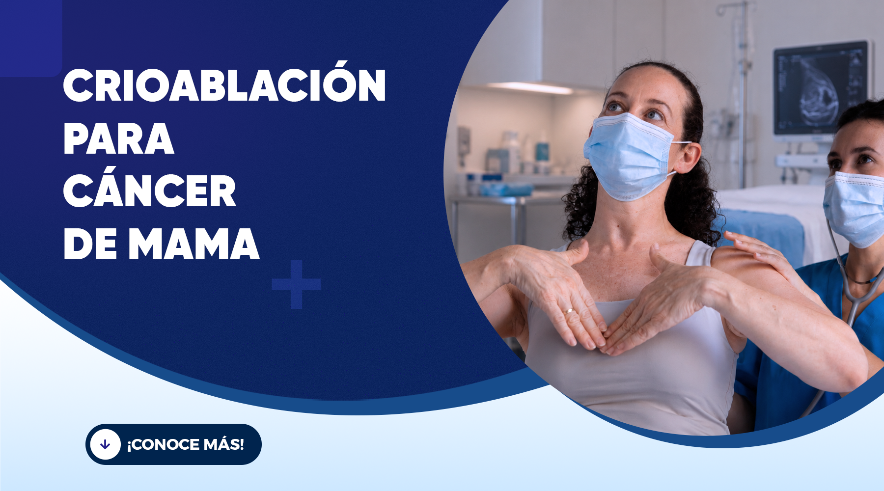 Crioablación para cáncer de mama